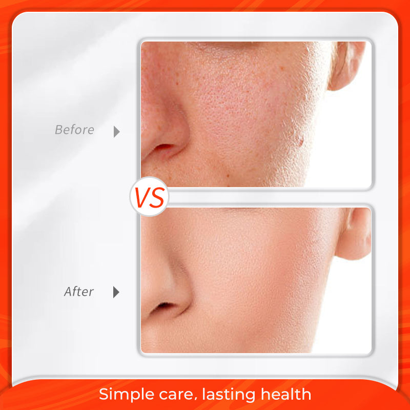 MeiYanMEI Meiyanqiong Deep Hydrating Emulsion 10pcs Hydrating and Nourishing Balance Water & Oil